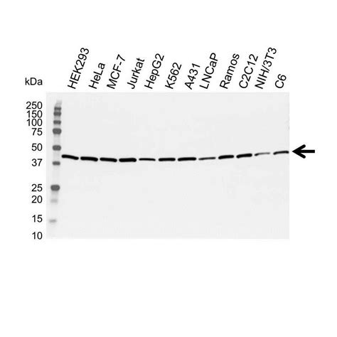 beta actin kda|beta actin Monoclonal Antibody .